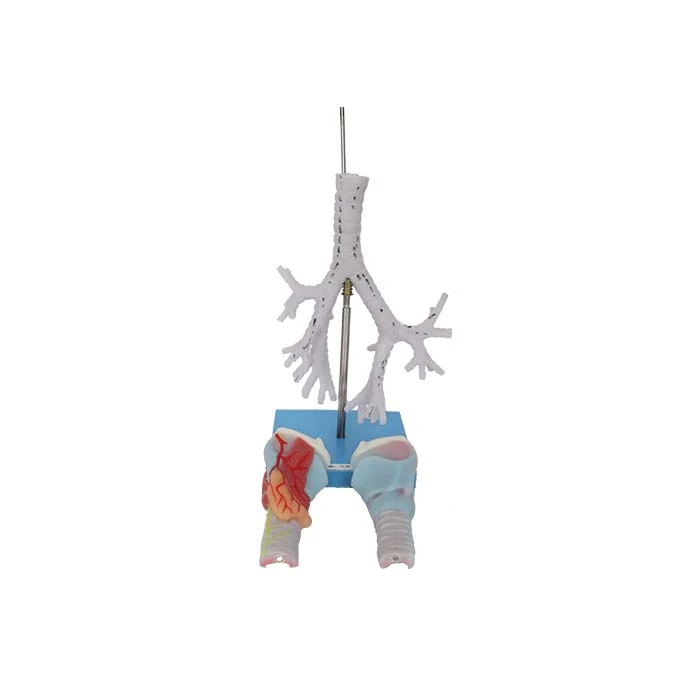 Múnla Larynx Agus Tracea